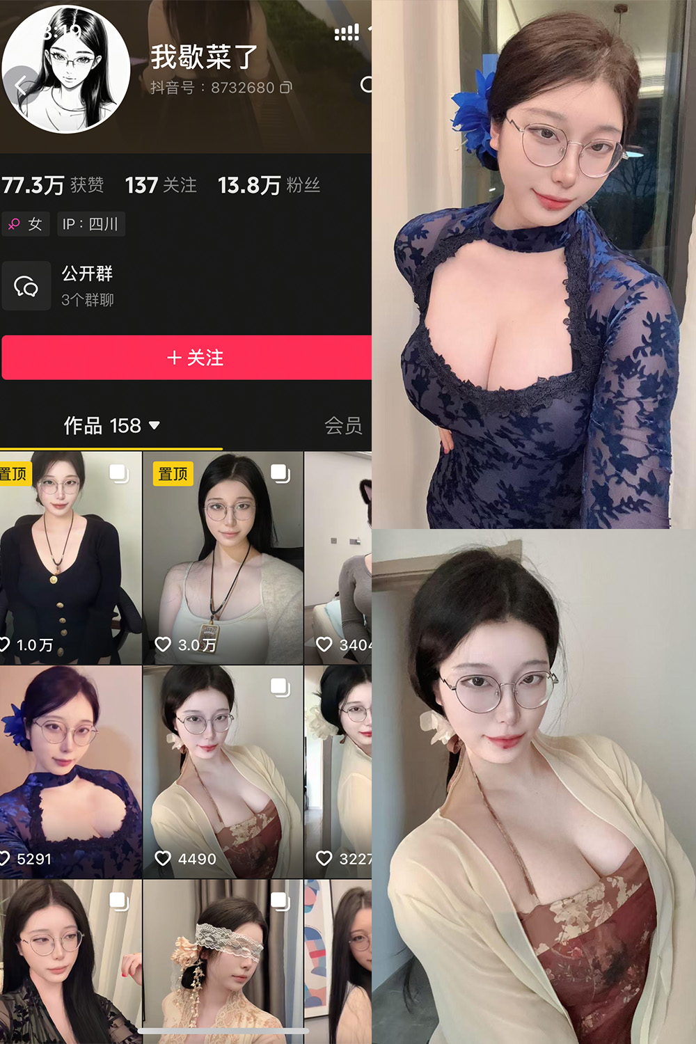 抖音 我歇菜了 微密圈 NO.001期 【10P】最新至:2025.4.19-微密空间